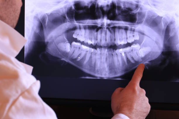 Best Emergency Tooth Extraction in Loretto, TN