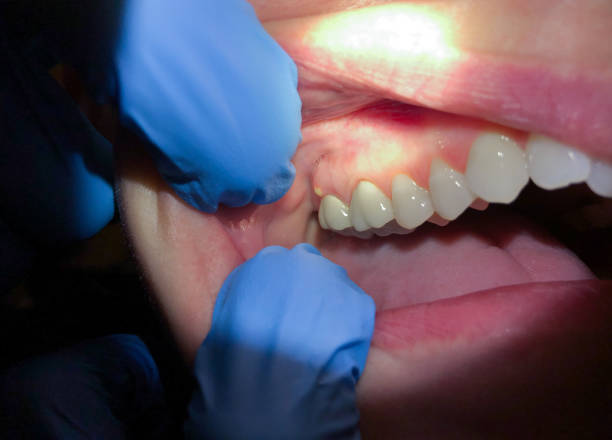 Best Emergency Treatment for Toothache in Loretto, TN